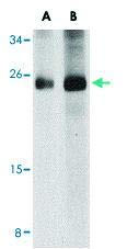 Pab16704-dimensiune : 100 micrograme-anticorp policlonal Anti-CDIP1 iepure-fiecare