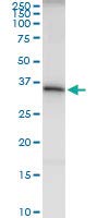 H00003705 - D01 - -anticorp policlonal Anti-ITPK1 iepure-fiecare